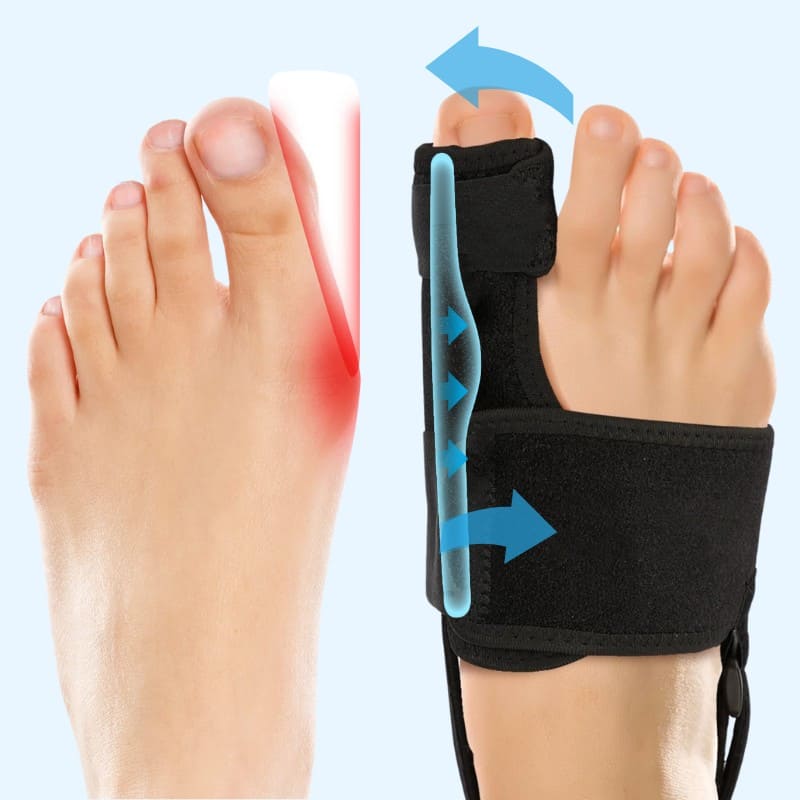 Parmiq™ Halluks Valgus Başparmak Destek Ateli
